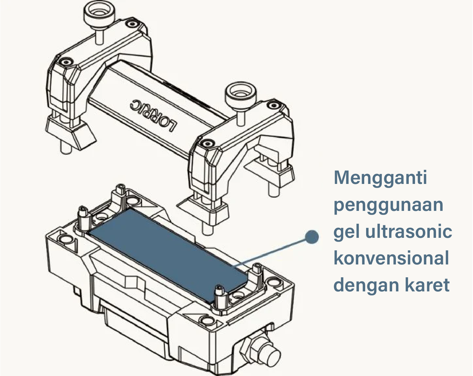 Tidak Perlu Lagi Repot dengan Penggunaan Gel Ultrasound yang Memboroskan Waktu dan Biaya