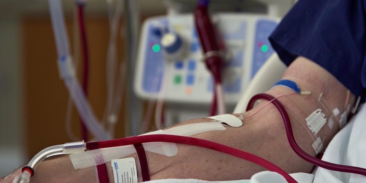 What is Dialysis? Understanding Hemodialysis and Ultra-Pure System